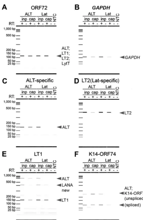 FIG 5 ALT is enriched in a strand-speciﬁc manner. Strand- and isoform-speciﬁc RT-PCR was performed onALT-captured, Lat-captured, or input RNA using the non-strand-speciﬁc primer pair ORF72 (A), negative-control GAPDH (B), the ALT-speciﬁc primer pair (C), t