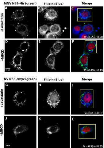 FIG 8 Colocalization of both the MNV NS3 and NV NS3 vesicular structures with the cholesterol ﬁlipin stainmethyl-is disrupted after treatment with lovastatin (A to C and G to I [n � 14 and 32, respectively]) but not�-cyclodextrin (MBCD) (D to F and J to L 