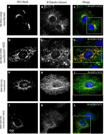 FIG 9 Both MNV NS3 and NV NS3 vesicular structures are dependent on microtubules and are disrupted upon nocodazole(NOZ) treatment