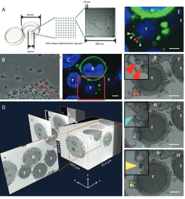 FIG 2 Experimental workﬂow used for CLEM of virological synapses. A coculture of ﬂuorescent HIV Gag-iGFP-expressing Jurkat T cells and uninfected primary CD4 T cells was prepared for correlative imaging