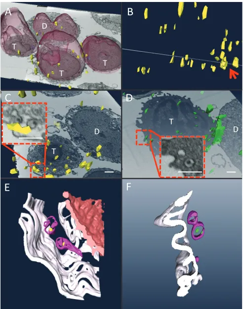 FIG 5 Correlation of small ﬂuorescent HIV Gag-containing puncta with electron-dense virus-like particlesAMD-3100-untreated sample in shown in Fig