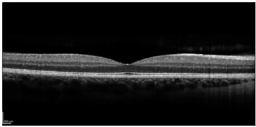 Figure 4 Scan of the retina belonging to the author of this thesis, showcasing the layered structure