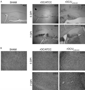 FIG 2 rOC/Us183–241 disseminates more rapidly in the brain and induces a stronger activation of astrocytesthan rOC/ATCC in infected mice