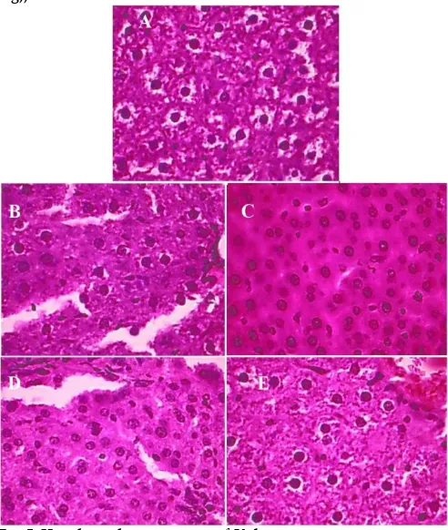Fig. 4: Histological investigation of Liver In-vivo study of Liver. A: Control (0.1% CMC), B: Diabetic Control, C: Reference Control (Glibenclamide), D: Compound C 200 (Hot Water Extract (200 mg)), E: Compound C 400 (Hot Water Extract (400 mg))