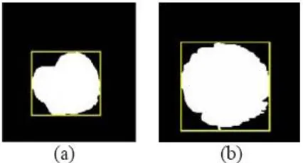 Figure 4: (a) K means clustering Image (b) Optic disc (c) Optic cup 