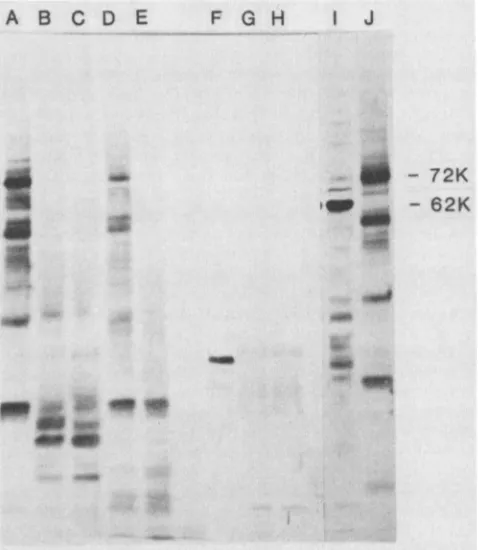 FIG. 7.auirelusextract.(0.5withaureusEBNAincubatedrespectively.EBNA,ug),,ug), SDS-polyacrylamide slab gel electrophoresis of EBNA l