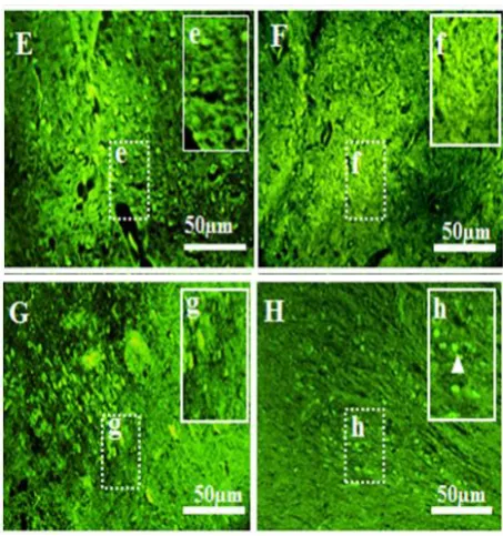 Figure 8. Effect of 6-HD and ZA administered in the  (VTA).MFB on the number of TH-positive cells in the substantia nigra (SN) and ventral tegmental area  F/Sham (A), M/Sham (B), F/PD (C), M/PD (D), F/ZA (E), M/ZA (F), F/PD plus ZA (G) and M/PD plus ZA (H)