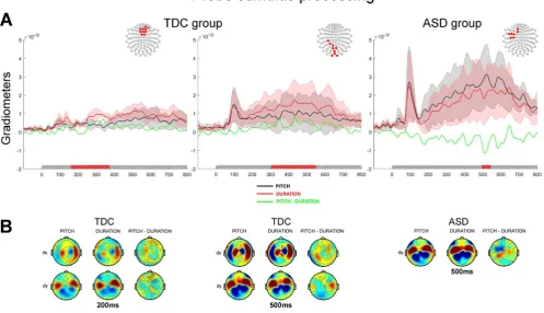 Fig. 6. Processing of the probe tone contrasted between Pitch and Duration discrimination tasks
