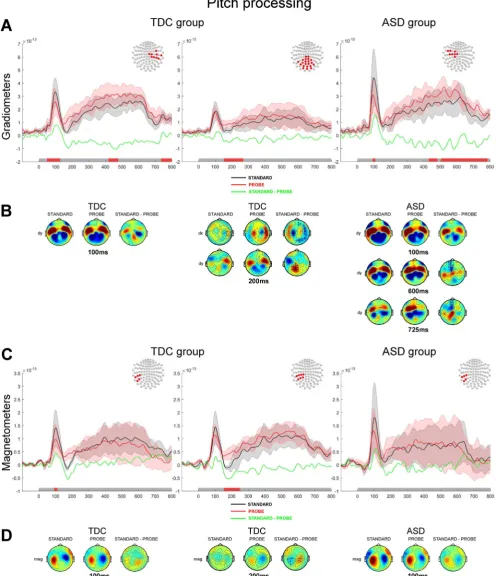 Fig. 7. Processing of auditory tone during the Pitch discrimination task contrasted between standard and probe tone presentations.signisensors shows the di A & C