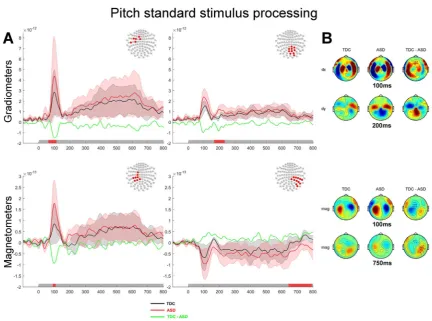Fig. 3. Processing of the standard tone during the Pitch discrimination task contrasted between groups.tone in the Pitch task.ometers