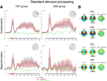 Fig. 5. Processing of the standard tone contrasted between Pitch and Duration discrimination tasks.derivative along the latitude; dy are derivative along the longitude), the bottom panel shows the topographies for magnetometers