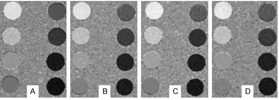 Figure 1. Fat fraction images of phantom groups (known fat volume ratio: first column from top to bottom, 95%, 80%, 65%, 50%; second column from top to bottom, 35%, 20%, 5%, 0%)