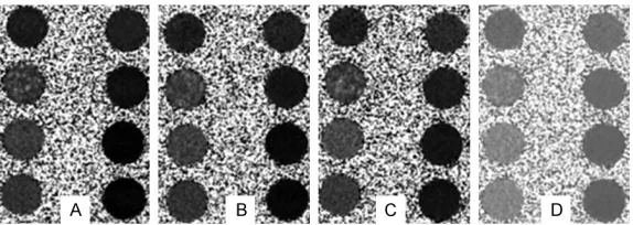 Table 1. MRI-pDFF of different phantom groups at different known fat volume ratio