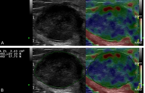 Figure 1 shows the ROC curv-