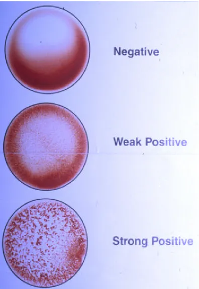 Figure 2.1- Objective visual interpretation guide for LA D-dimer assay. 