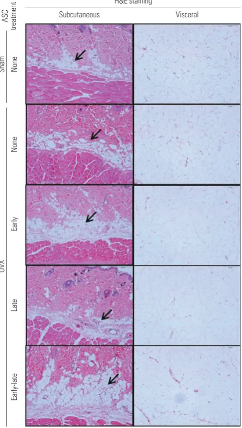 Fig. 4. Histological evaluation of ovariectomized rats with or without ASC injection. ASC injection during the early period (Week 1 and 2), late period (Week 5 and 6), or both after OVX