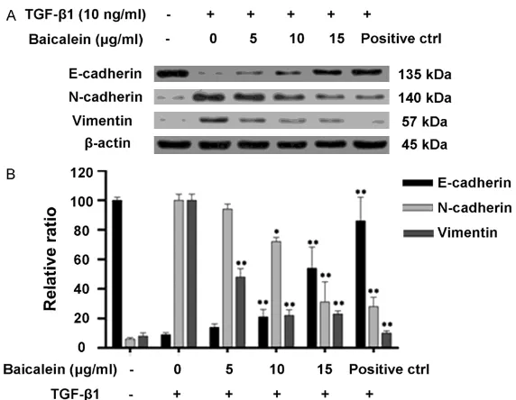 Figure 3. The effect of different doses of TGF-β1 and baicalein on the exherin, N-cadherin, vimentin and β-actin were determined by Western blot