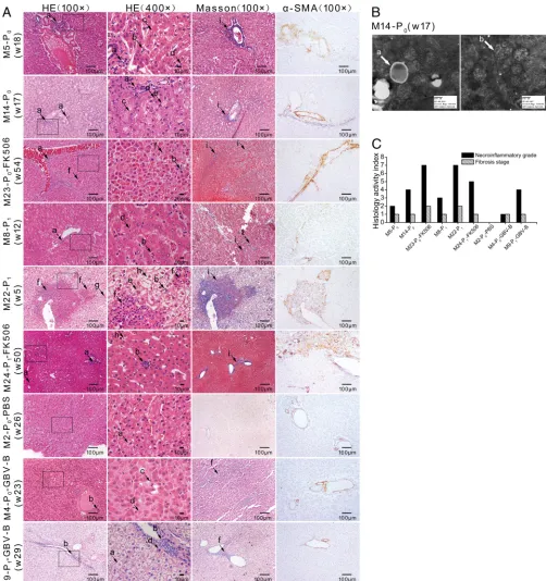 FIG 6 Histopathologicalobservationoflivertissuesfrominfectedmarmosets.(A)LivertissuesofmarmosetswerestainedwithH&E,Masson’strichrome,andThe lowercase letters with arrows indicate histopathological features: lymphocytic inﬁltrates (a), focal necrosis (b), s