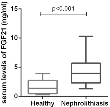 Table 1. Clinical characteristics of patients with nephrolithiasis and healthy volunteers, Data are shown as means ± SD