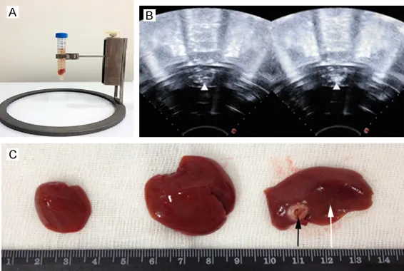 Figure 2. folds. B. Changes in ultrasonic echo of the target regions after HIFU. HIFU ablation