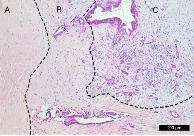 Figure 3. Light microscopy. Presentations of liver in the experimental group (C, F, I) under light microscope after differences were found between the blank (A, D, G) and control groups (B, E, H)