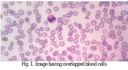 Fig. 1. Image having overlapped blood cells  