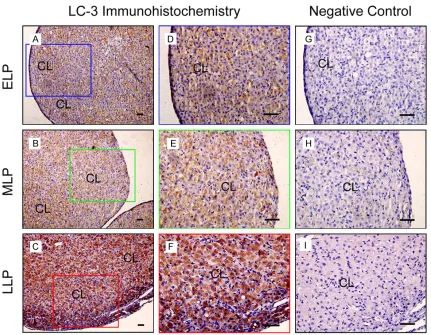Figure 1. Expression and localization of LC-3 during the luteal development in the ovaries of pregnant rats