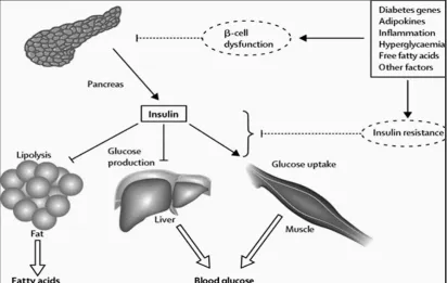 Figure 1: Pathogenesis of Insulin Resistance and Beta cell dysfunction42