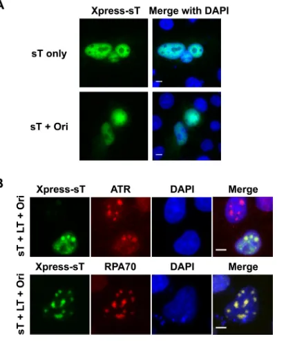 FIG 8 MCPyV sT translocates to viral DNA replication factories in the pres-ence of the viral Ori and LT