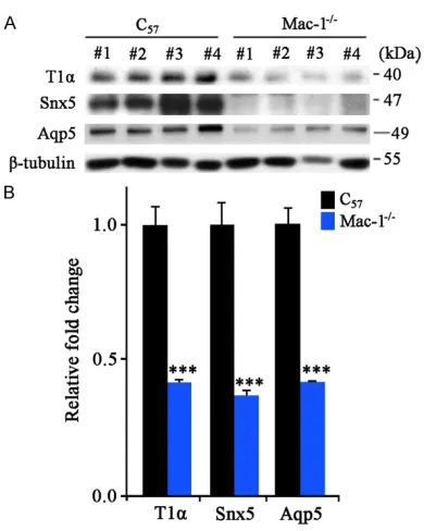 Figure 4. The specific proteins of type I alveolar cells, and B. Showed the statistical results
