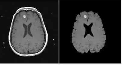 Figure 3: Pre-Processed Image 