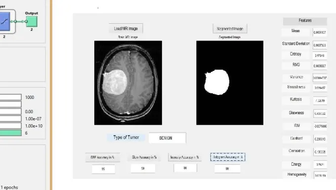 Figure 7: GUI OF proposed Model 