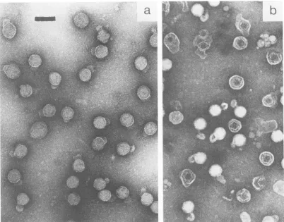 FIG.1.100 Electron micrograph of intact (a) and partially disrupted (b) 46 bacteriophages negatively stained with 2% PTA