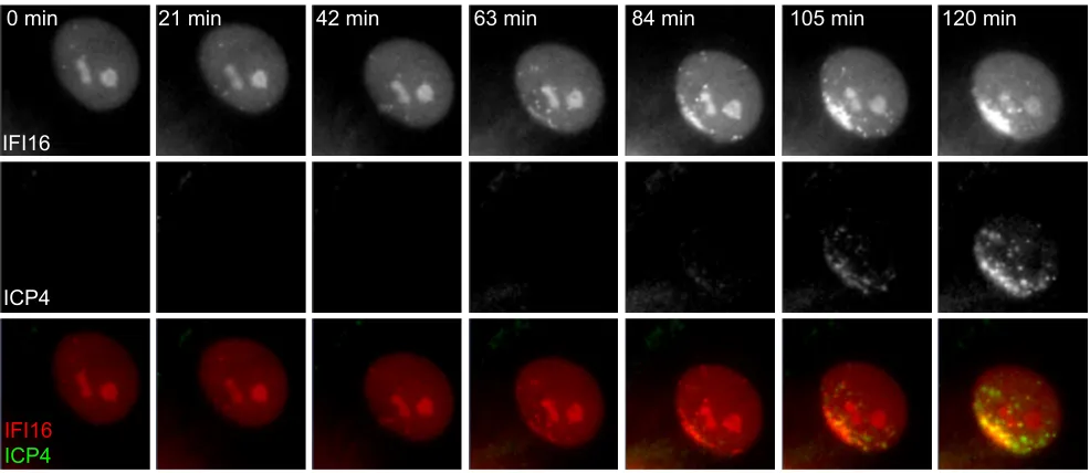 FIG 3 Detection of the rapid response of IFI16 to HSV-1 infection. (A) HFs expressing EYFP-IFI16 were infected with ICP0-null mutant HSV-1 (MOI of 50),and then images were captured at the indicated times after addition of the virus