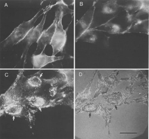 FIG. 2.antibodiesaffinitydarkerpaneltransformed Localization of the Abelson virus transforming protein (P120W<'9-abl) by indirect immunofluorescence