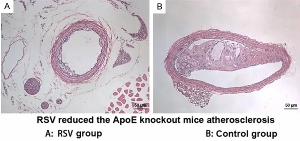 Figure 7. RSV attenuated AS in ApoE-/- mice. (Original magnification: ×200).