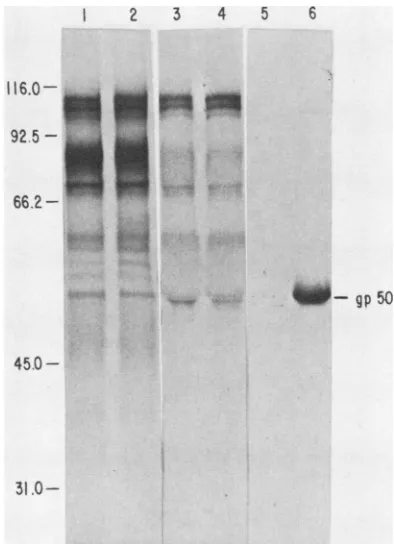 FIG. 2.BqmHI-digestedelectrophoresedeachrecombinantpACYC184insertlane.striction Ethidium bromide-stained agarose gel containing PRV clones