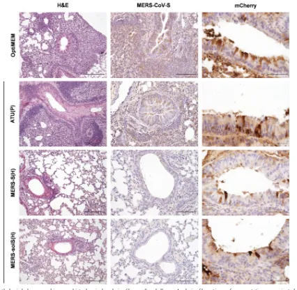 FIG 7 Histopathological changes and immunohistochemical analysis of lungs after challenge