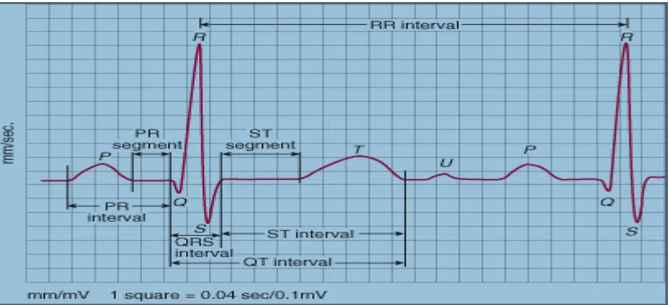 Fig. 1 shows a representation of an ECG with normal waveform 