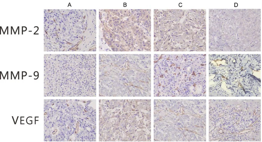 Figure 2. Histologic sections of VX2 liver tumors after treatment in all group (hematoxylin and eosin staining, original magnification ×100 and ×400)