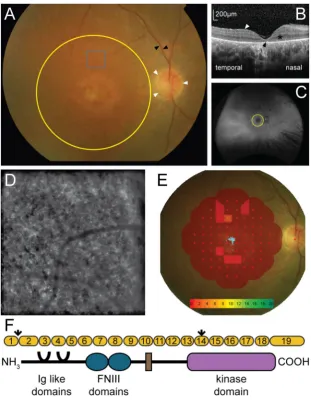 Figure 1. Phenotypic characterisation of an individual with MERTK associated retinal dystrophy