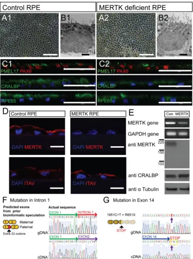 Figure 2. Characterisation of control and MERTK-RPE. (A1,2) Light micrograph of control and MERTK-RPE cells in culture (scale bar 50 μm)