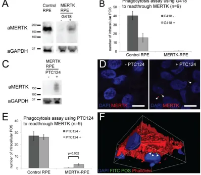 Figure 4. Translational readthrough inducing drugs are able to restore expression of MERTK in the MERTK-RPE and have an effect on phagocytosis