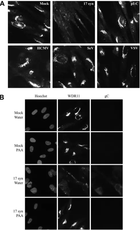 FIG 3 WDR11 relocalization is speciﬁc to HSV infection and requires virallate gene expression