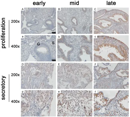 Figure 1. Expression of FOXO1 in endometrial tissue during the menstrual cycle of human