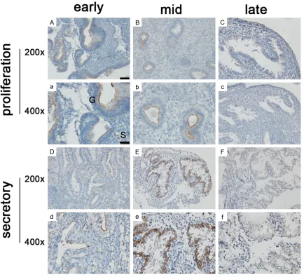 Figure 2. Expression of FOXO3 in endometrial tissue during the menstrual cycle of human