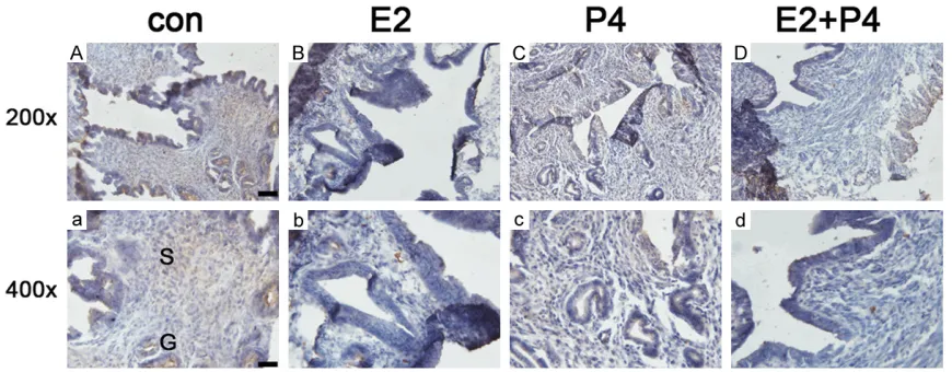 Figure 5. Effects of E2 and P4 on FoxO1 in the ovariectomized mouse uterus. A, a: The expression of FoxO1 treated by control in the ovariectomized mouse uterus; B, b: The expression of FoxO1 treated by E2 in the ovariectomized mouse uterus; C, c: The expre