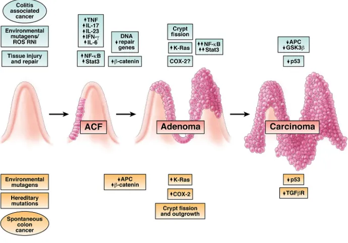 Figure 1.4 Fearon–Vogelstein model of colon carcinogenesis. The sequential events of 