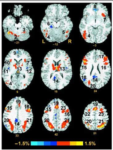 Figure 1. Regions showingdifferences in activation duringRVIP and control taskperformance