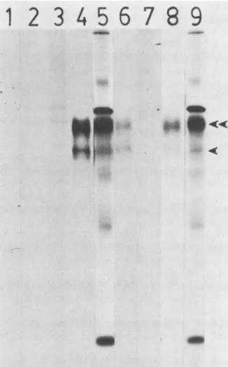 FIG. 6.labeled Fluorograph of ElA proteins from AdS-infected cells with [35S]methionine or 32P and immunoprecipitated by the